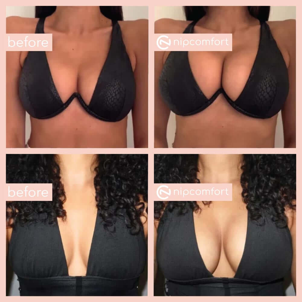 Nipcomfort™ Instant Volume Sticky Bra Inserts